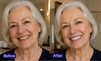 SmileGlow™ Whitening Strips